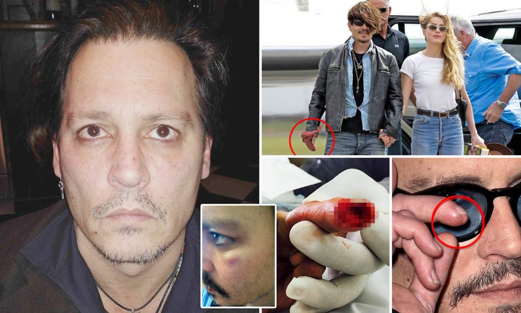 depp