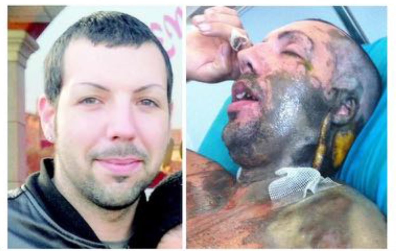 William Pezzulo umiliato due volte. Ma ora basta.