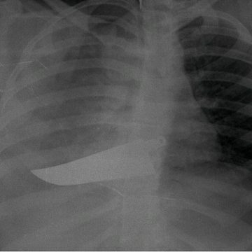 Lo stupidario mediatico del 25 novembre